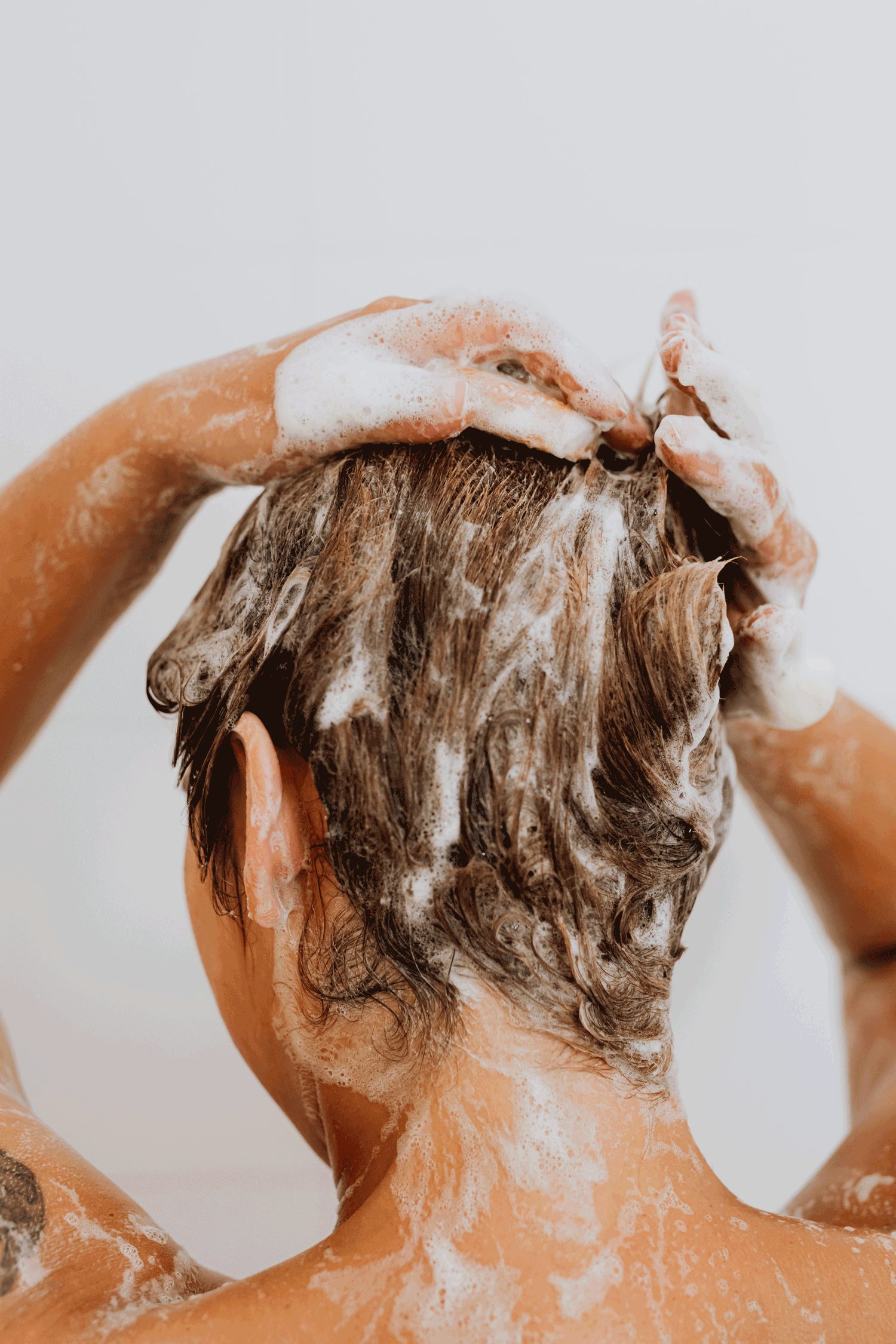 Hair-Loss