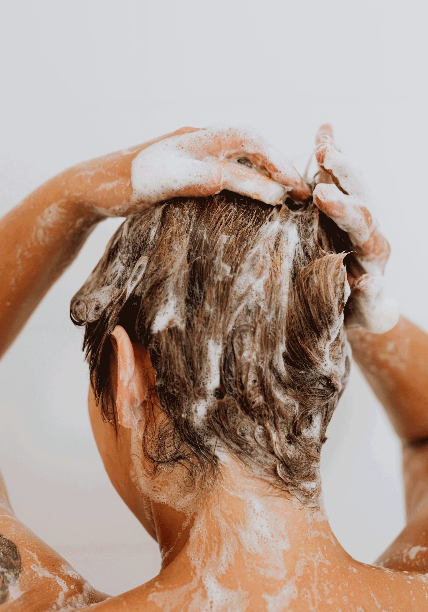 Hair-Loss Hair-Loss