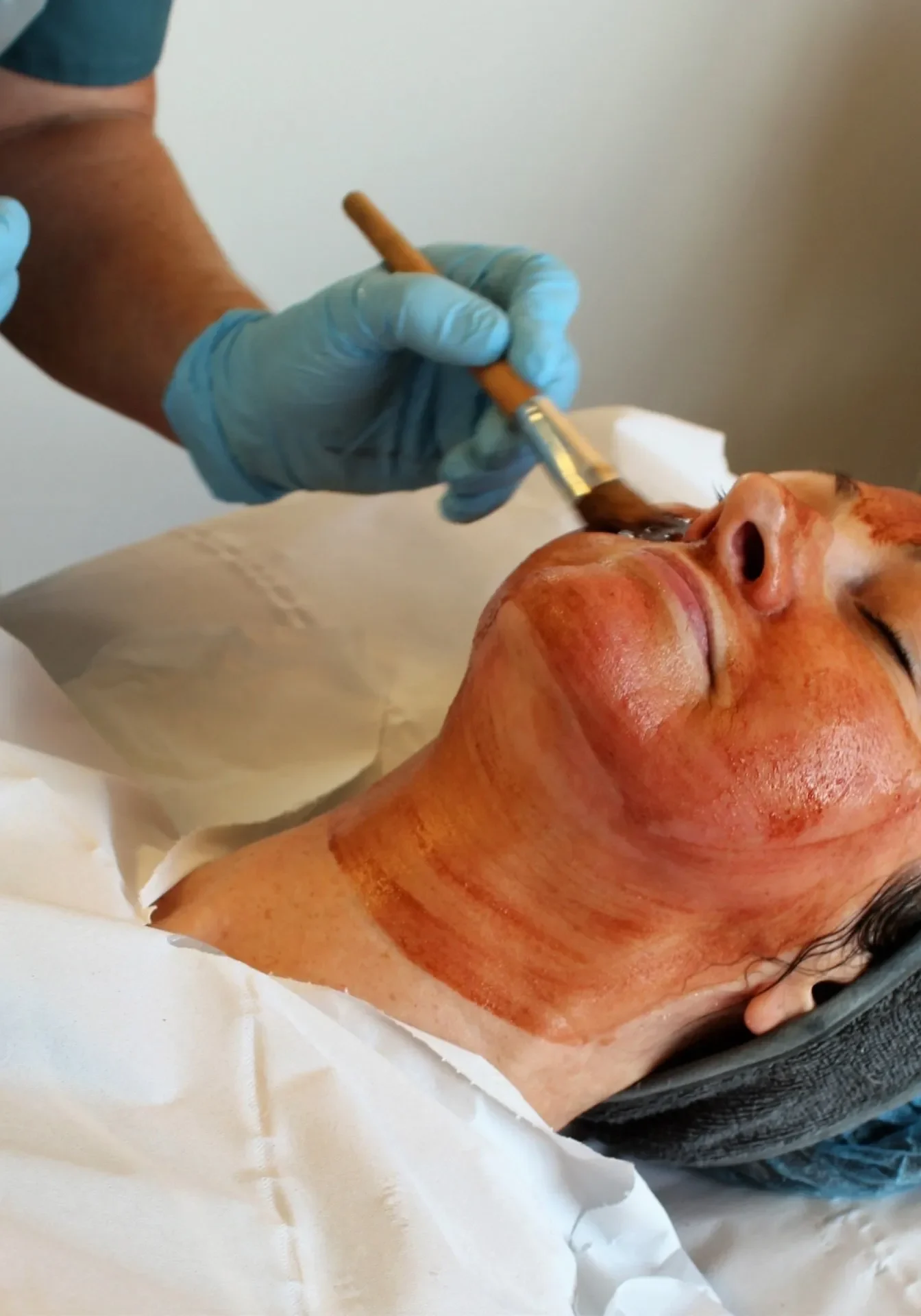 Hydrafacials